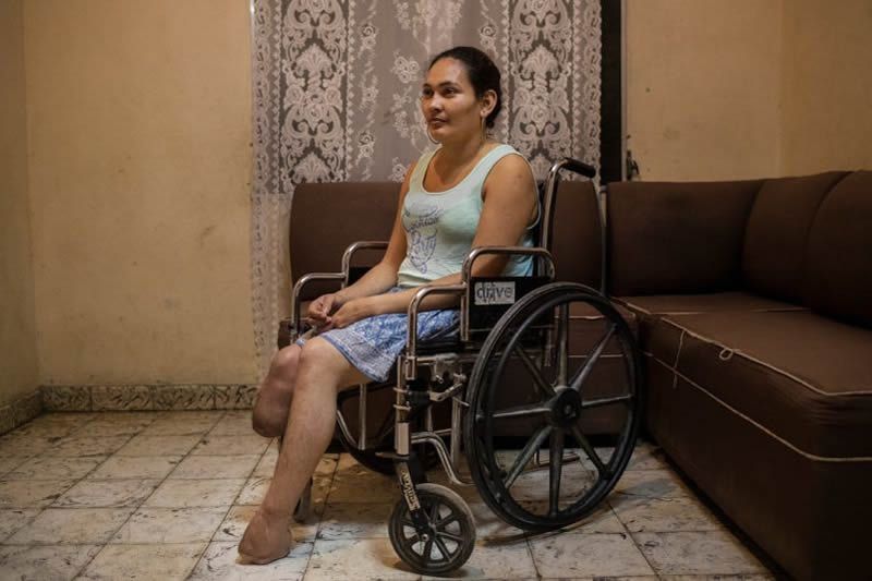 Heydi Waleska Hernández, de 32 años, perdió los pies a consecuencia de un ataque de su exesposo, cuando vivían en Choloma. Credit Victor J. Blue para The New York Times