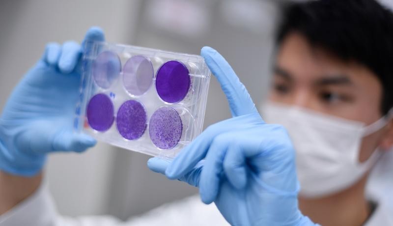  Researcher in Brazil working on virus replication in order to develop a vaccine against the coronavirus. Photo by DOUGLAS MAGNO/AFP via Getty Images. 